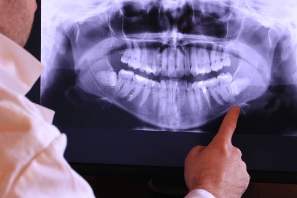 Best Emergency Dental Care for Trauma or Injury in Springfield, VA