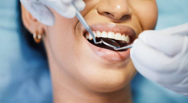 Best Emergency Root Canal Treatment in Springfield, VA