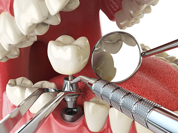 Best Weekend Emergency Dentist in Springfield, VA
