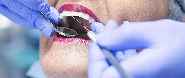 Best Emergency Broken Tooth Repair in Springfield, VA